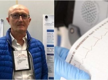 Massa: una tecnologia innovativa che migliora l’efficacia del trattamento della fibrillazione atriale - apuane