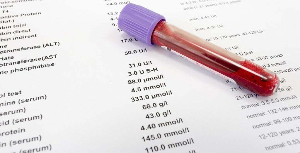 Aulla: nuovo servizio gratuito di prenotazione degli esami del sangue - esami, lunigiana
