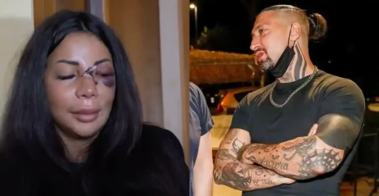 Martina Mucci sfregiata a Prato, il suo ex condannato a 9 anni Martina Mucci sfregiata a Prato, il suo ex condannato a 9 anni - emiliano laurini, martina mucci