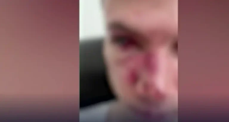 "Sporco italiano", studente 18enne insultato e picchiato dal branco a Bressanone - alto adgine, bressanone